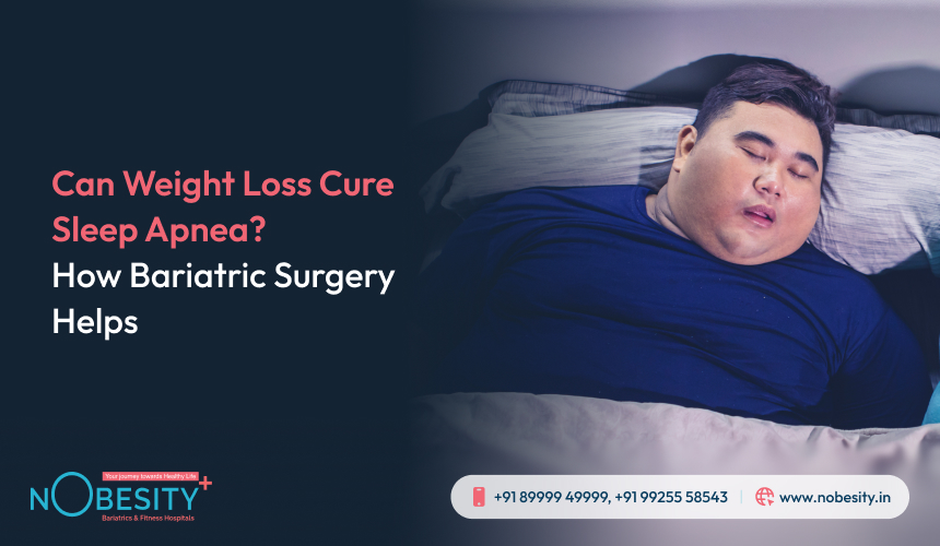 Can Weight Loss Cure Sleep Apnea? How Bariatric Surgery Helps